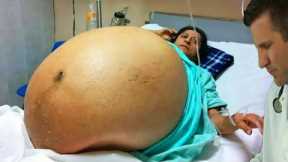 10 Most Unusual Pregnancy Conditions You Won't Believe Are Real