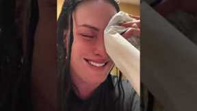 She mixed up eye drops with superglue!
