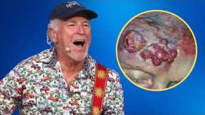 The Rare and Shocking Disease That Killed Jimmy Buffett