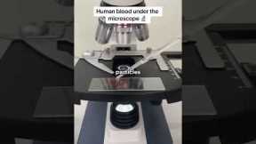 Human Blood Under A Microscope