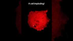 Watch A Cell IMPLODE Up-Close