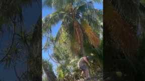 Coconut Falls On Unlucky Man's Head