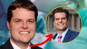 Matt Gaetz's Transformation is Turning Heads