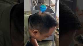 Spinning Toy On Balding Head