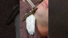 Ancient Leech Therapy Technique